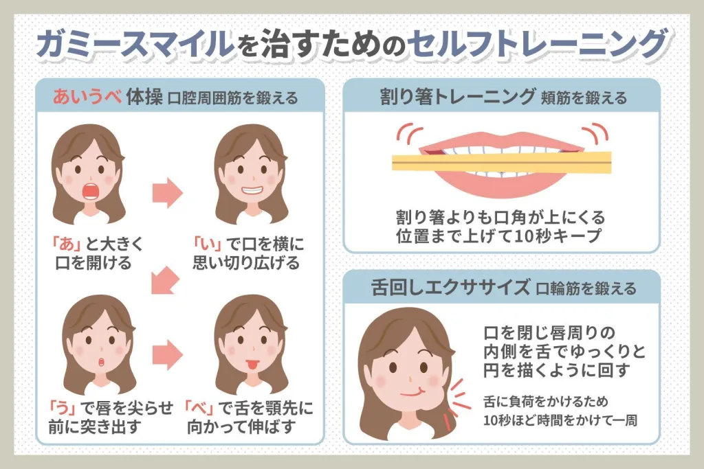 ガミースマイルを治すためのセルフトレーニング