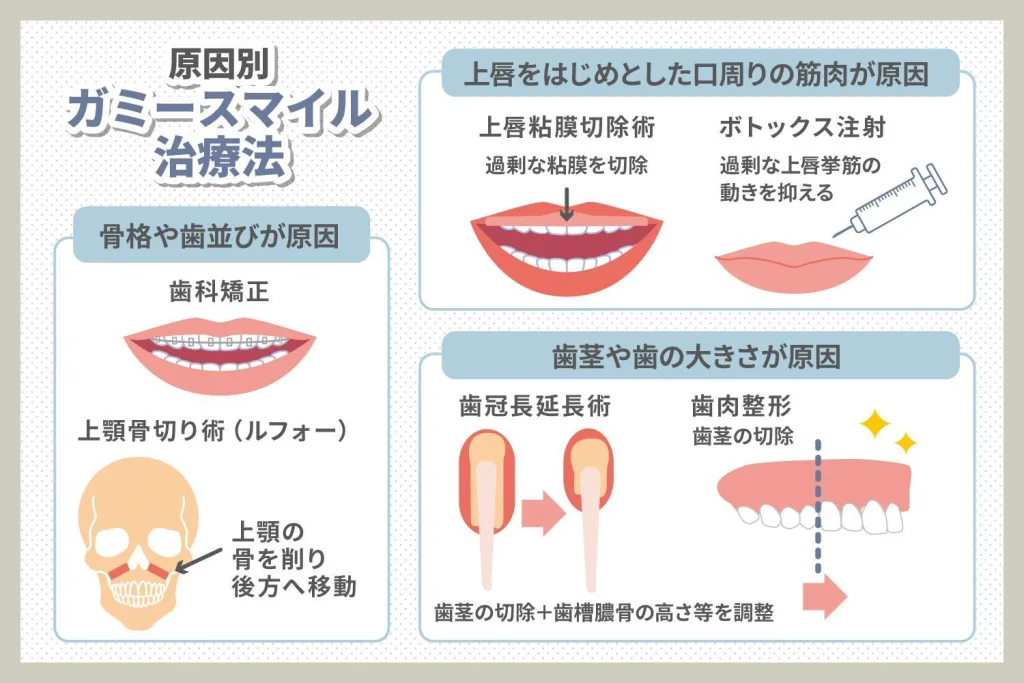 原因別ガミースマイルの治療方法