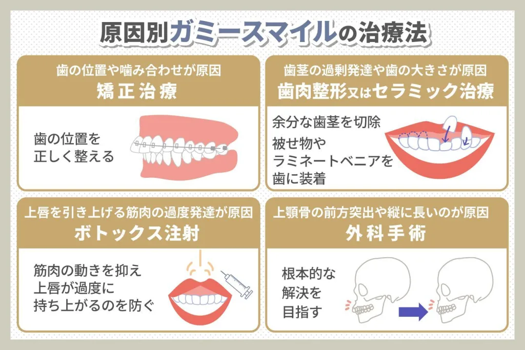 ガミースマイルの治療法