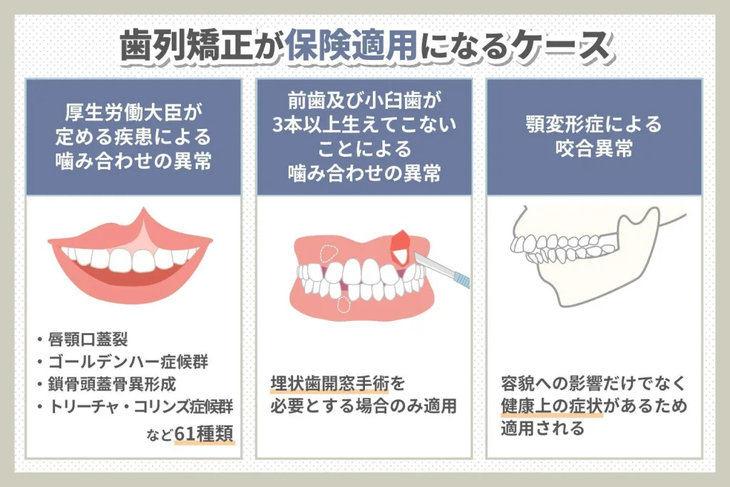 歯科矯正で保険適用になるケース