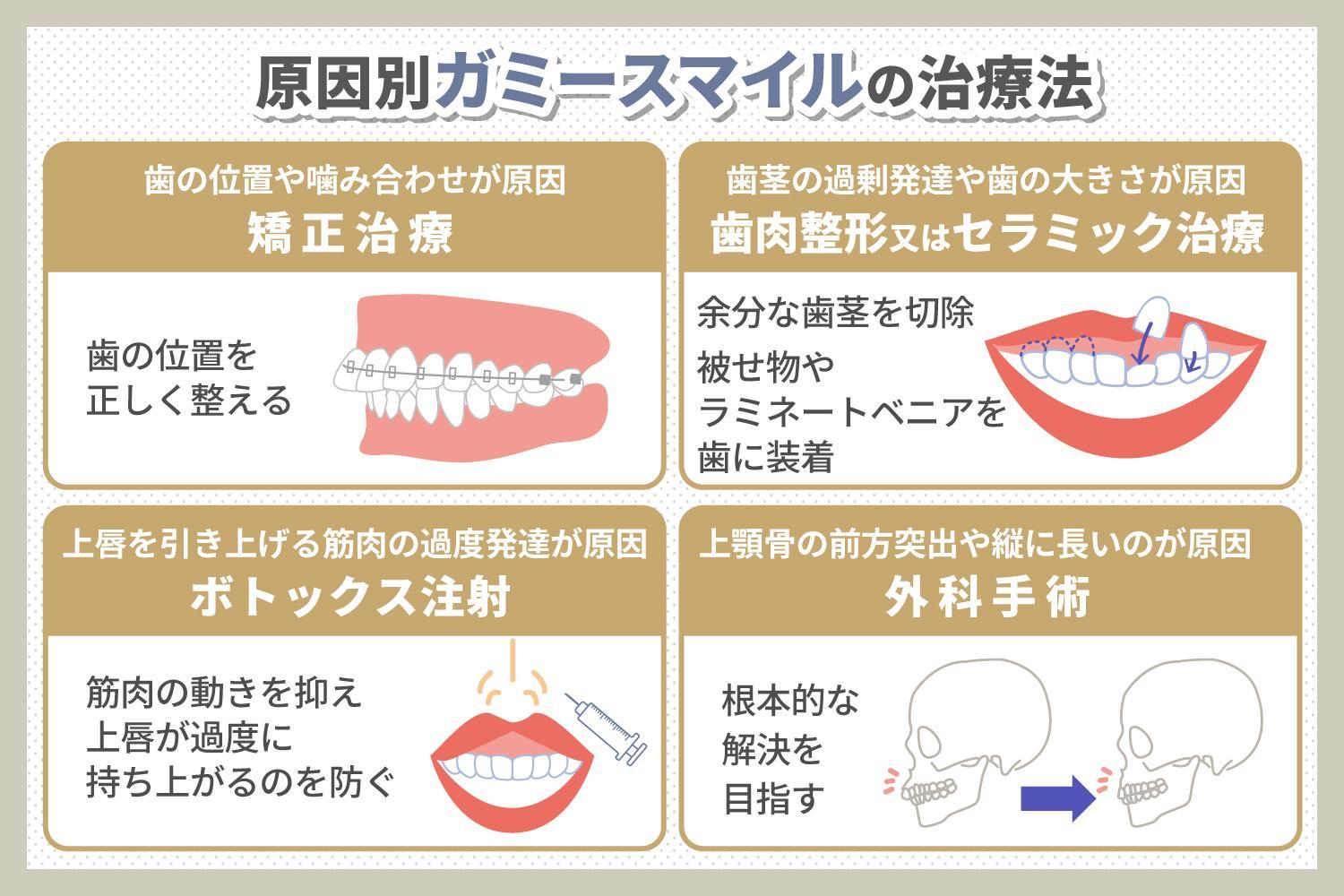 歯が小さいとガミースマイルになる？　歯の大きさとの関係や治療方法を解説