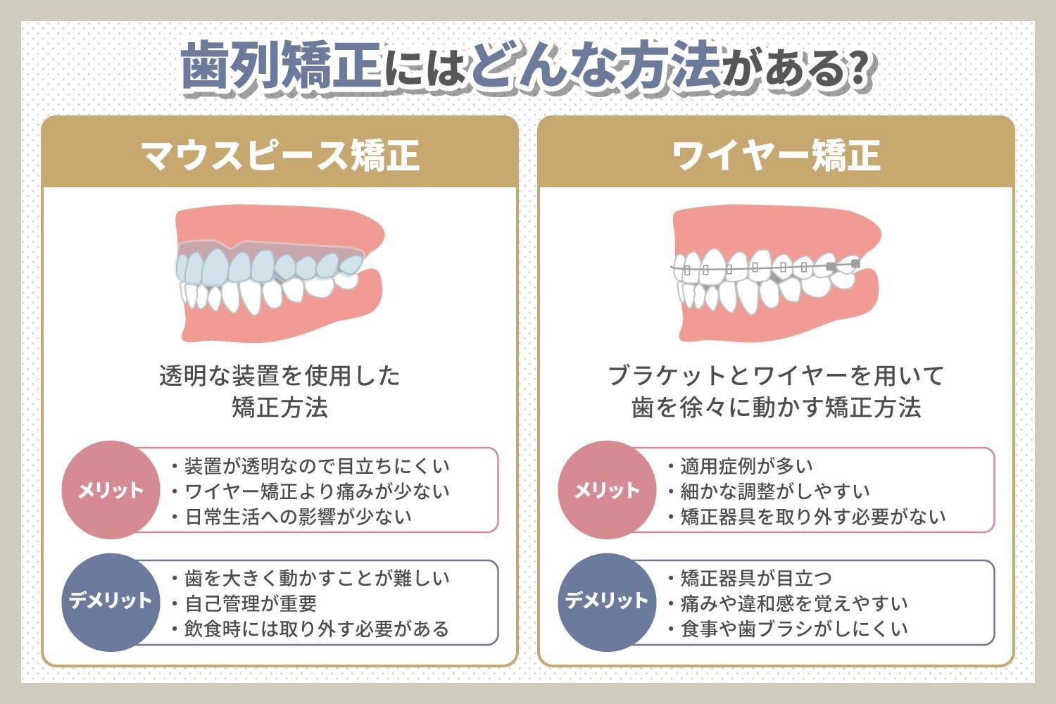 ガミースマイルの原因は出っ歯のせい？矯正方法や違いを解説