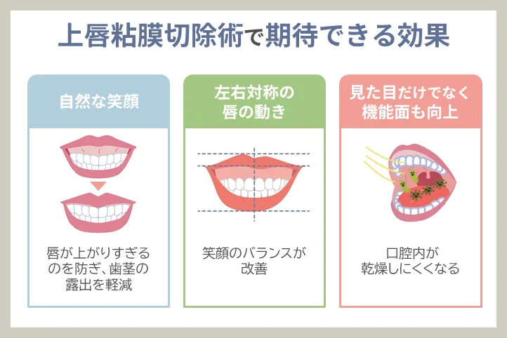 上唇粘膜切除術の基本情報と期待できる効果