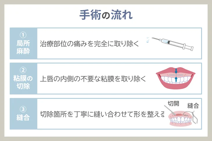 局所麻酔から縫合までの具体的な流れ