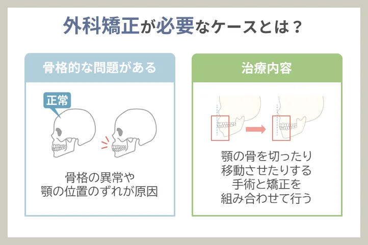 外科矯正が必要なケースとは？